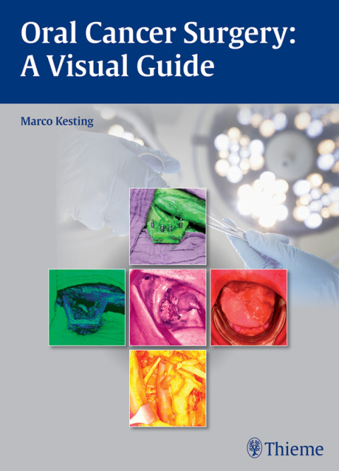Cover image for book Oral Cancer Surgery