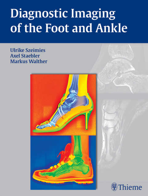 Cover image for book Diagnostic Imaging of the Foot and Ankle