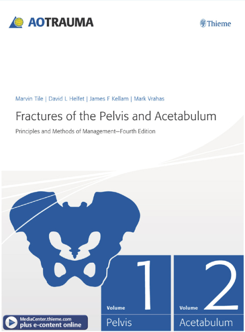 Fractures of the Pelvis and Acetabulum 