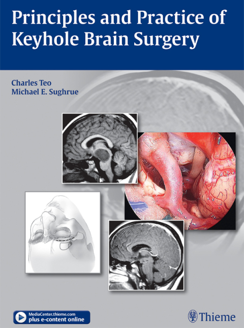Cover image for book Principles and Practice of Keyhole Brain Surgery