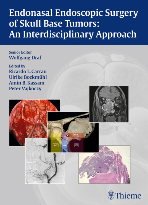 Cover image for book Endonasal Endoscopic Surgery of Skull Base Tumors: An Interdisciplinary Approach