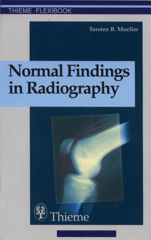 Cover image for book Normal Findings in Radiography