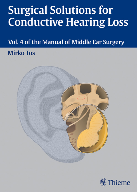 Cover image for book Surgical Solutions for Conductive Hearing Loss