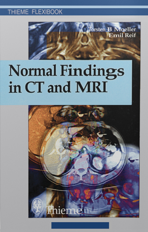 Cover image for book Normal Findings in CT and MRI