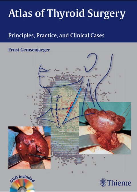Cover image for book Atlas of Thyroid Surgery