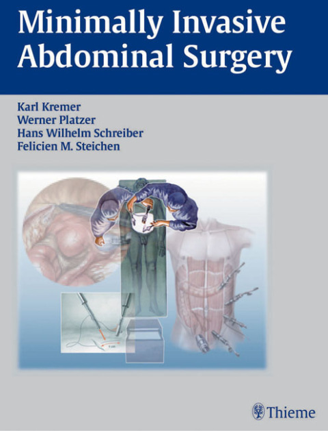 Cover image for book Minimally Invasive Abdominal Surgery