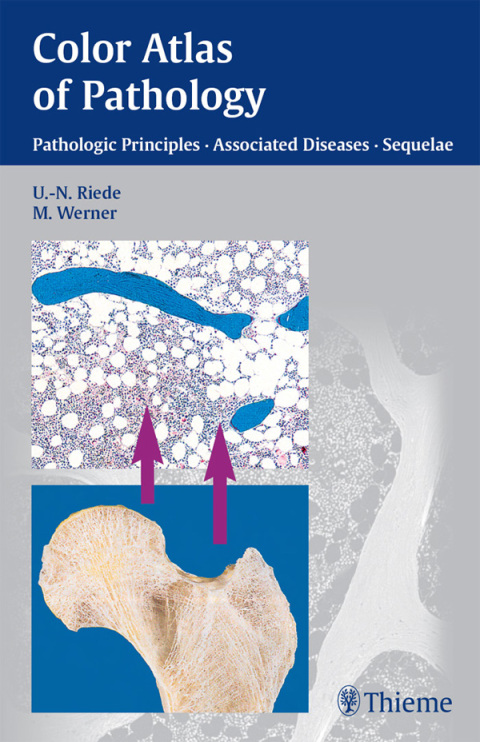 Cover image for book Color Atlas of Pathology