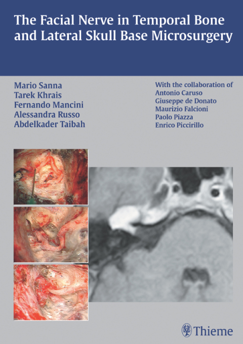 The Facial Nerve in Temporal Bone and Lateral Skull Base Microsurgery 