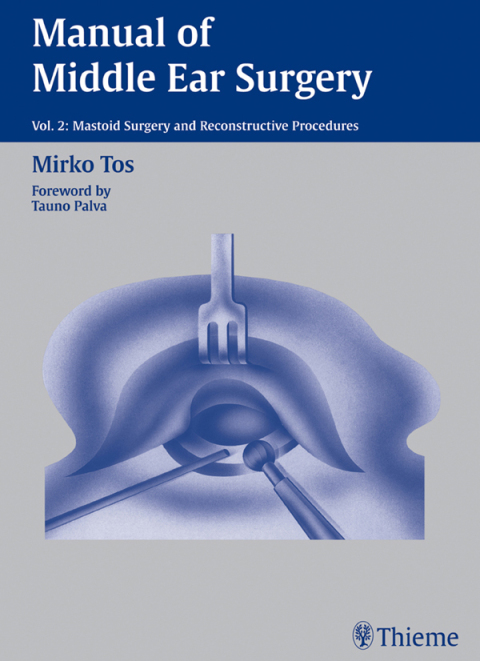 Cover image for book Manual of Middle Ear Surgery