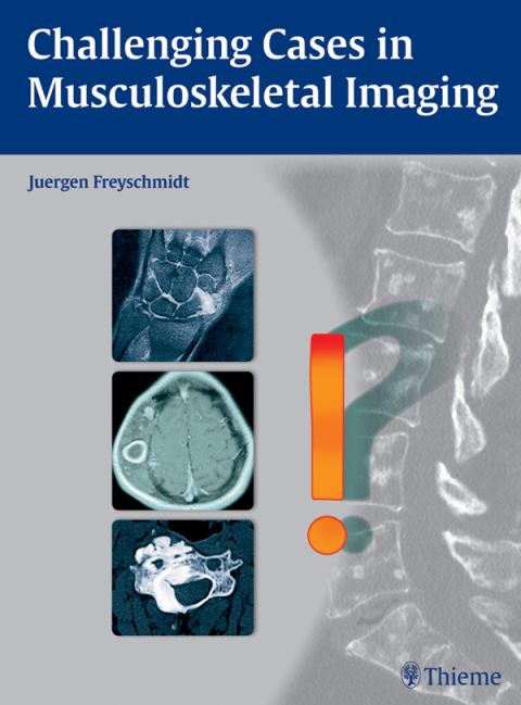 Cover image for book Challenging Cases in Musculoskeletal Imaging