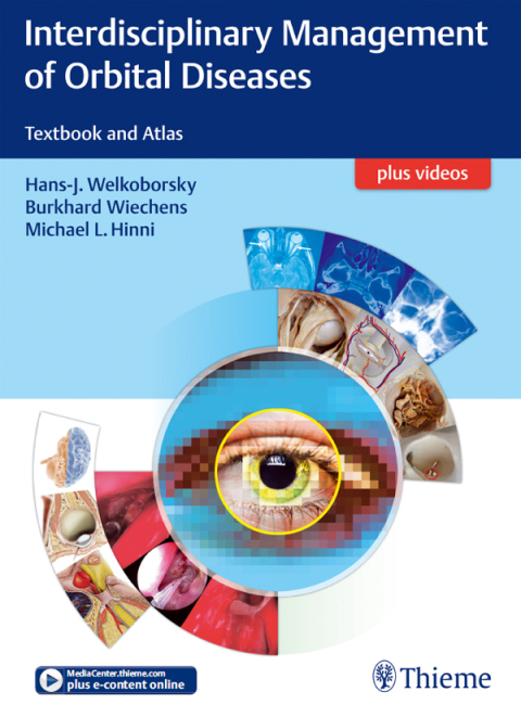Cover image for book Interdisciplinary Management of Orbital Diseases