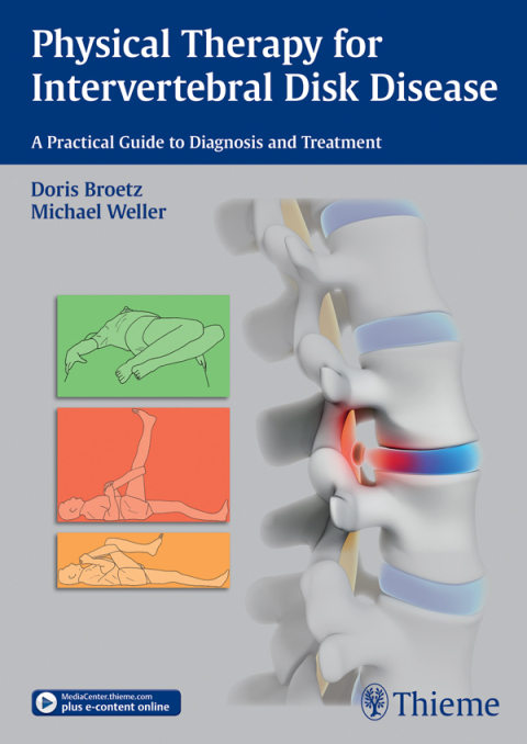 Physical Therapy for Intervertebral Disk Disease 