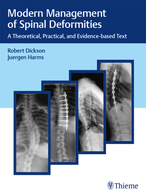 Cover image for book Modern Management of Spinal Deformities