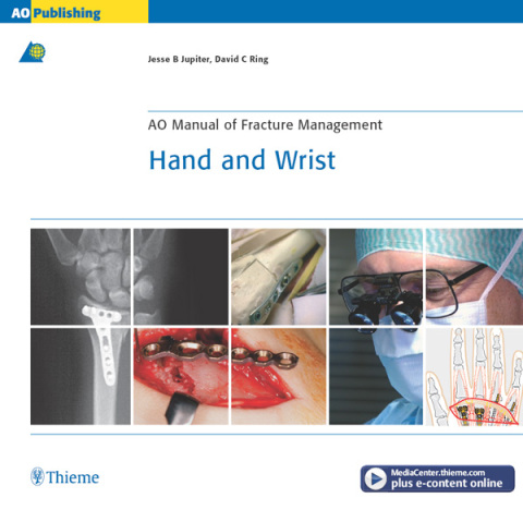 Cover image for book AO Manual of Fracture Management - Hand and Wrist