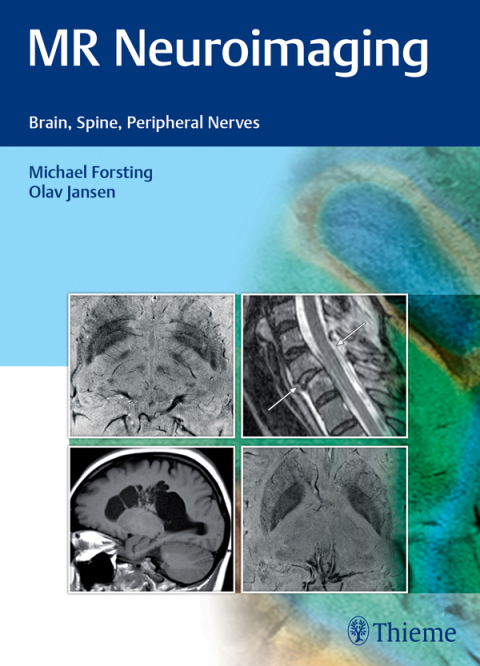 Cover image for book MR Neuroimaging