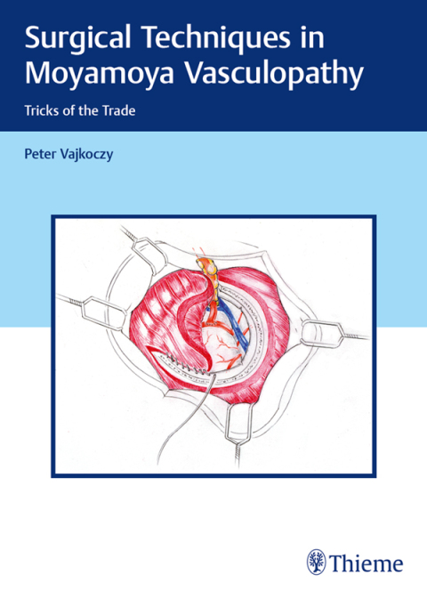 Cover image for book Surgical Techniques in Moyamoya Vasculopathy
