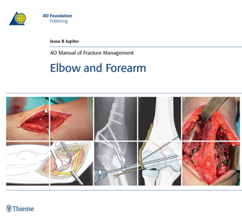 Cover image for book AO Manual of Fracture Management - Elbow and Forearm