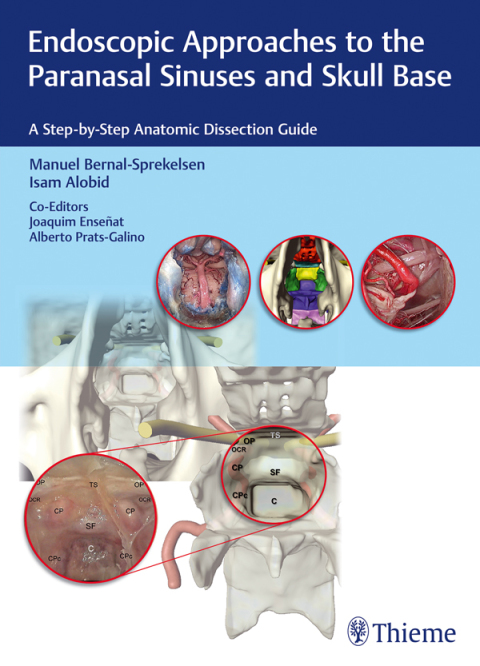 Cover image for book Endoscopic Approaches to the Paranasal Sinuses and Skull Base