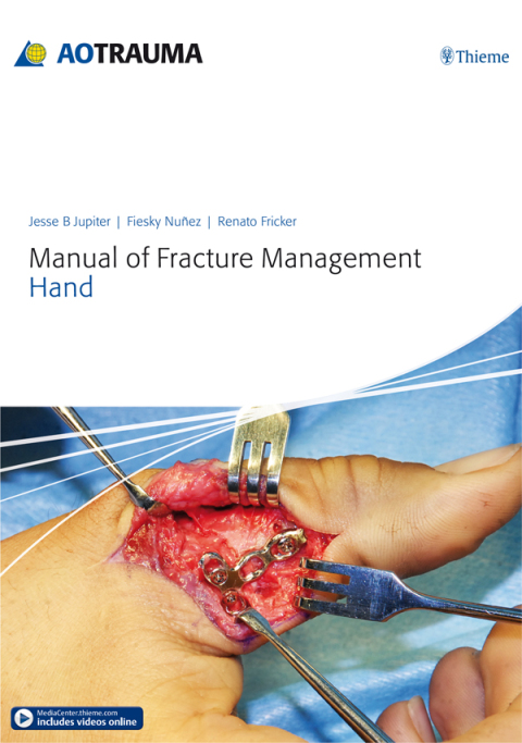 Cover image for book Manual of Fracture Management - Hand