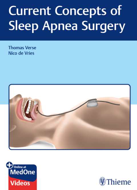 Cover image for book Current Concepts of Sleep Apnea Surgery