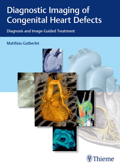Cover image for book Diagnostic Imaging of Congenital Heart Defects