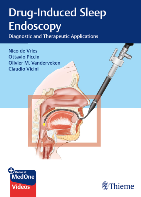 Cover image for book Drug-Induced Sleep Endoscopy