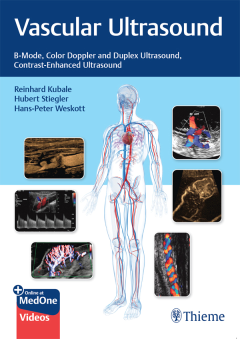 Cover image for book Vascular Ultrasound