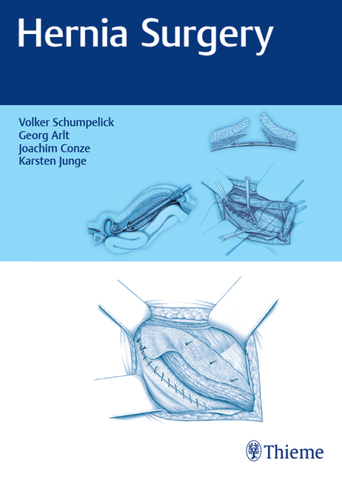 Cover image for book Hernia Surgery