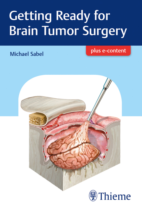 Cover image for book Getting Ready for Brain Tumor Surgery