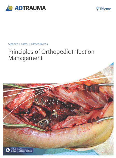 Cover image for book Principles of Orthopedic Infection Management