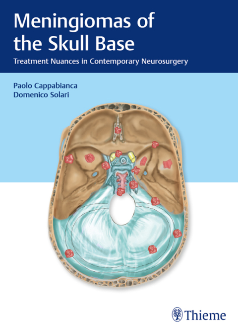 Cover image for book Meningiomas of the Skull Base
