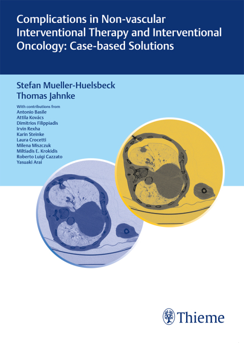 Cover image for book Complications in Non-vascular Interventional Therapy and Interventional Oncology: Case-based Solutions