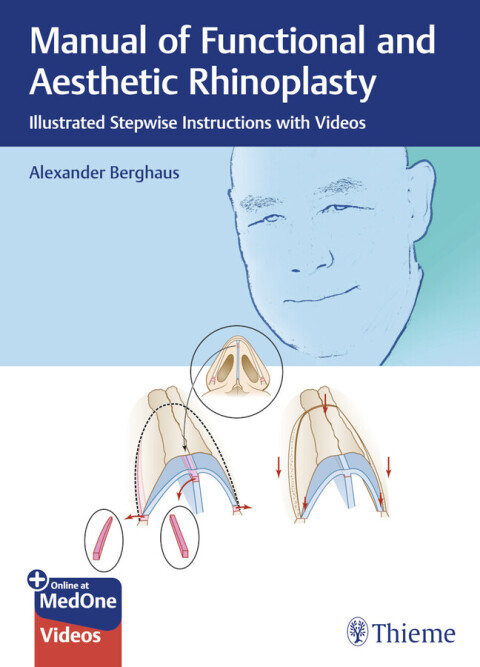 Cover image for book Manual of Functional and Aesthetic Rhinoplasty