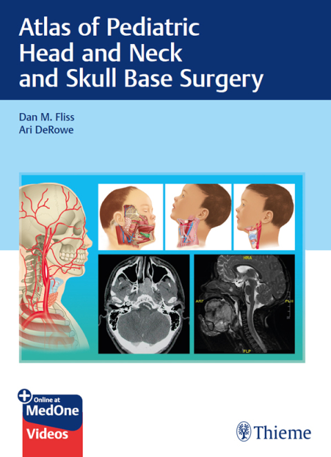 Cover image for book Atlas of Pediatric Head and Neck and Skull Base Surgery
