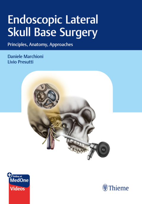Cover image for book Endoscopic Lateral Skull Base Surgery