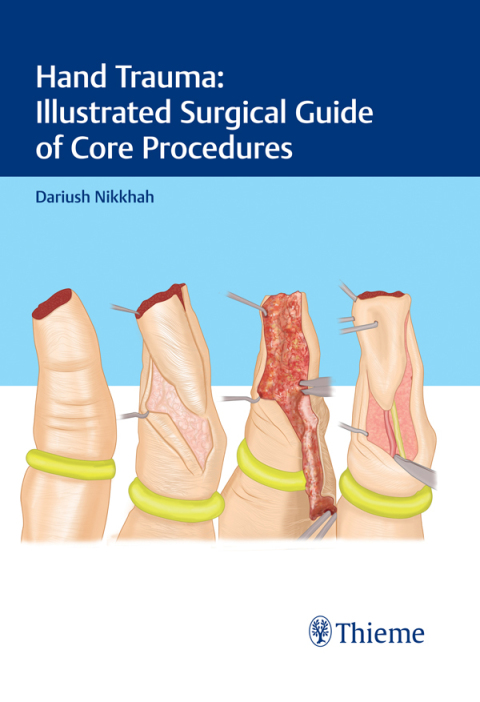 Cover image for book Hand Trauma: Illustrated Surgical Guide of Core Procedures