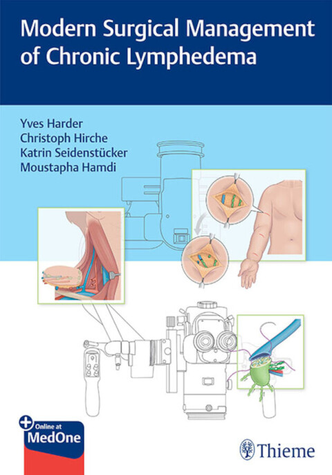 Cover image for book Modern Surgical Management of Chronic Lymphedema