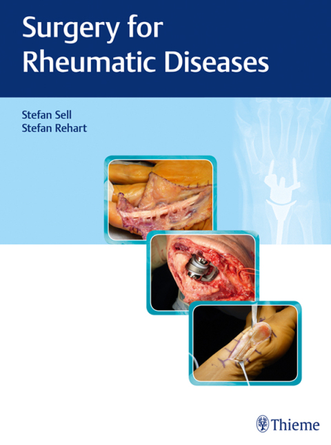 Cover image for book Surgery for Rheumatic Diseases