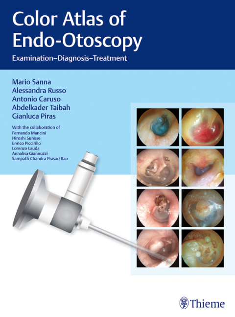 Color Atlas of Endo-Otoscopy 