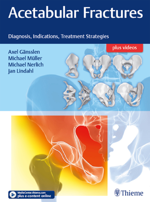 Cover image for book Acetabular Fractures