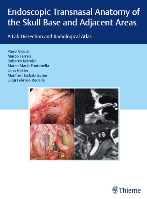Cover image for book Endoscopic Transnasal Anatomy of the Skull Base and Adjacent Areas