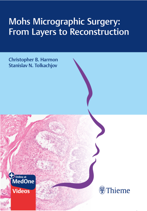 Cover image for book Mohs Micrographic Surgery: From Layers to Reconstruction