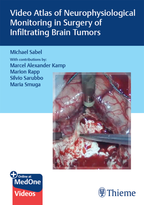 Cover image for book Video Atlas of Neurophysiological Monitoring in Surgery of Infiltrating Brain Tumors