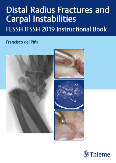 Cover image for book Distal Radius Fractures and Carpal Instabilities