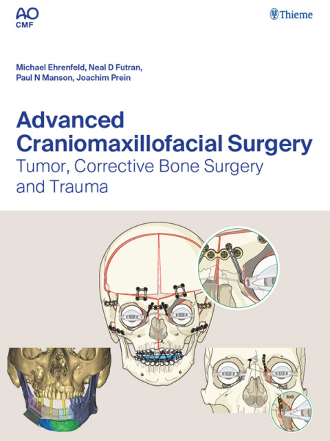 Advanced Craniomaxillofacial Surgery 