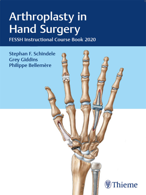 Cover image for book Arthroplasty in Hand Surgery