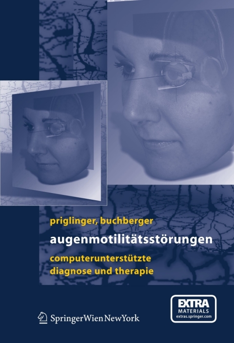 Cover image for book Augenmotilitätsstörungen