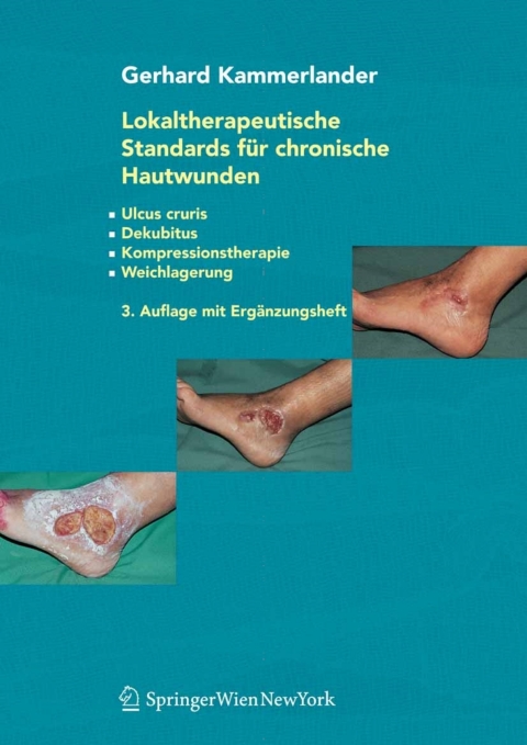 Cover image for book Lokaltherapeutische Standards für chronische Hautwunden