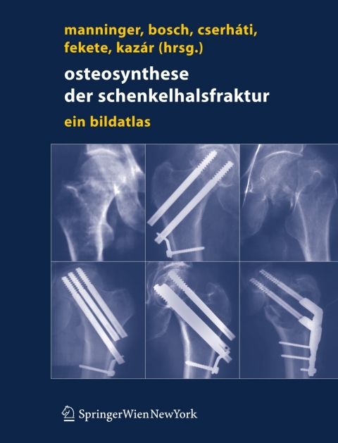 Cover image for book Osteosynthese der Schenkelhalsfraktur