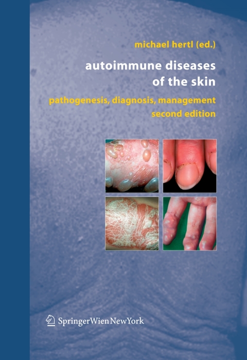 Cover image for book Autoimmune Diseases of the Skin